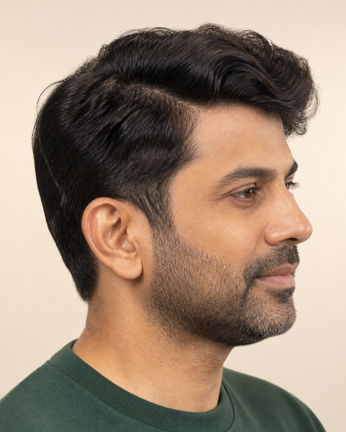 Luxury Mirage Hair Patch for Men, Premium Silk Base - close-up of the temple blend