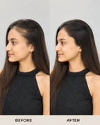Side Hair Patch, Clip-In Temple Coverage - before and after result