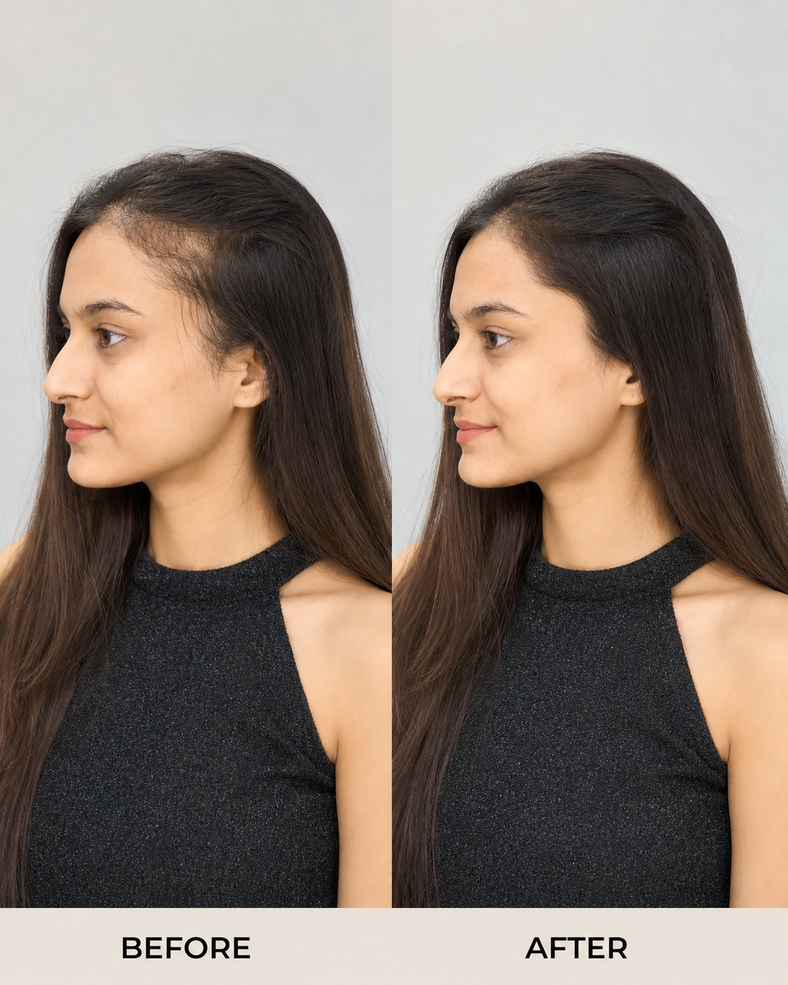 Side Hair Patch, Clip-In Temple Coverage - before and after result